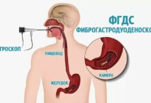 Photo of ФГДС: диагностика патологий желудка с высокой точностью