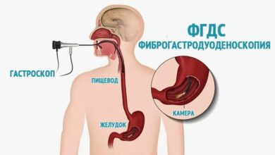 Photo of ФГДС: диагностика патологий желудка с высокой точностью